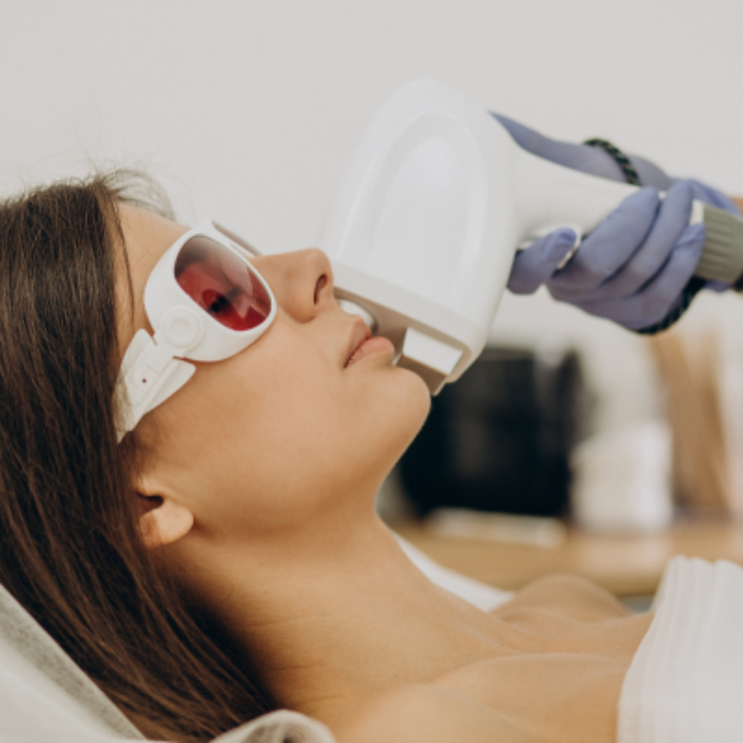 O tratamento a laser para manchas de pele é uma abordagem comum para reduzir a aparência de manchas escuras