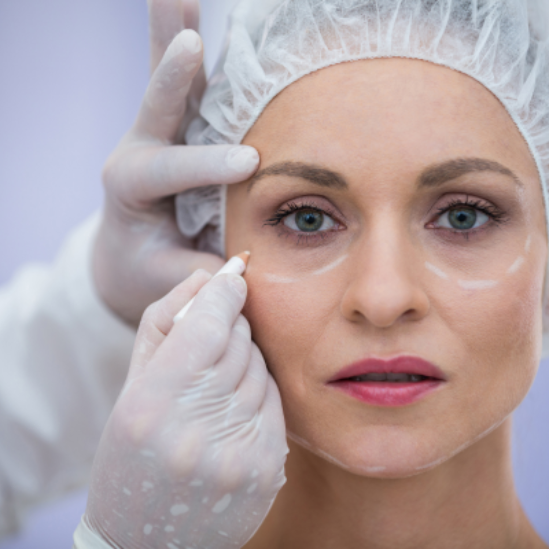 O Botox é uma das opções mais populares para combater rugas e linhas de expressão